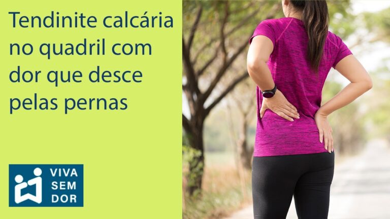 Sintomas da Calcificação no Quadril: O que Você Precisa Saber