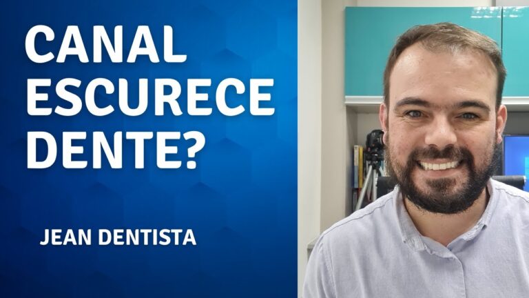 Escurecimento de Dente com Canal: Causas e Soluções