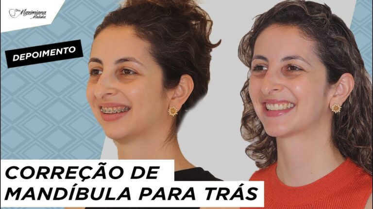 Mandíbula para Trás: Causas e Soluções