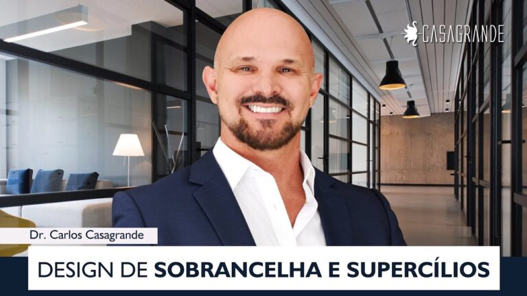Onde Encontrar Supercílios?