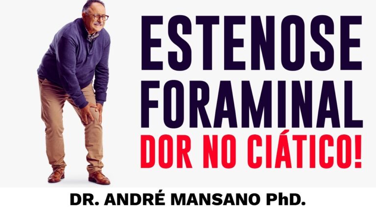 Estenose Foraminal: Entenda o Que É e Seus Efeitos