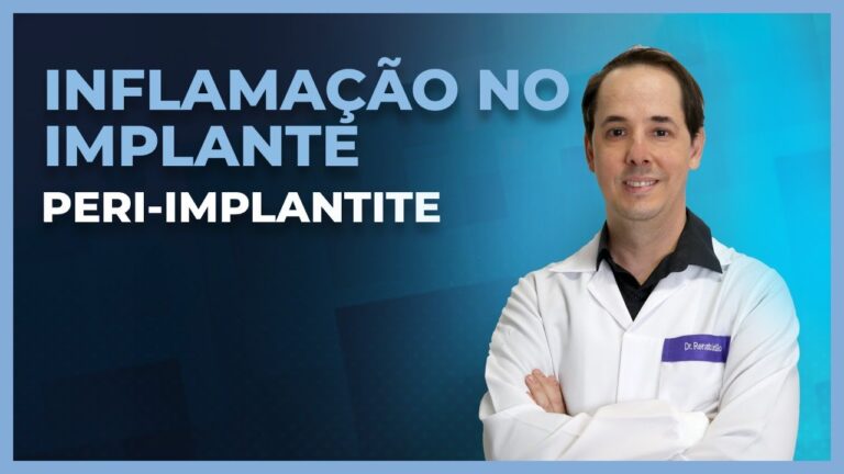 Sintomas de Inflamação em Implante Dentário