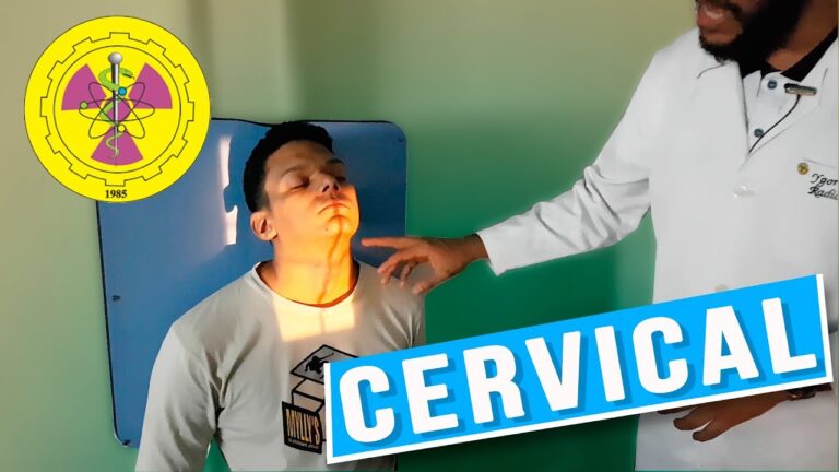 RX Coluna Cervical: 3 Incid&ecirc;ncias Essenciais