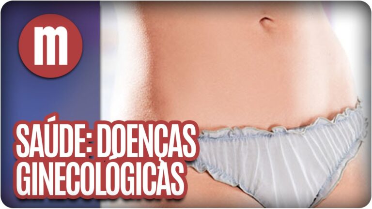 Explorando Doen&ccedil;as Ginecol&oacute;gicas Raras: Diagn&oacute;stico e Tratamento