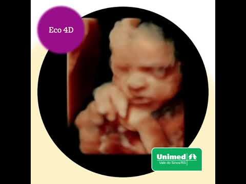 Valor da Ecografia 3D: Benefícios e Importância na Diagnóstico