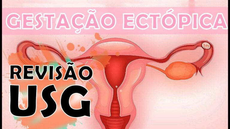 Líquido na Cavidade Uterina: Indício de Gravidez?