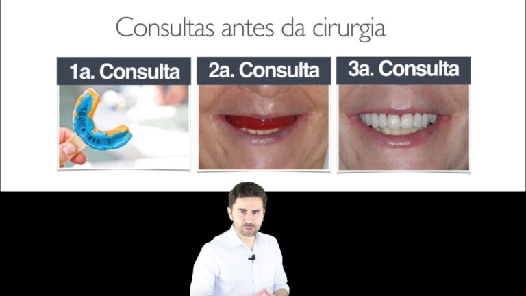 Como é Feito um Implante Dentário: Fotos e Passo a Passo