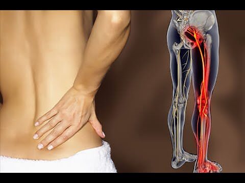 Entendendo os Neuroforames Lombares: Importância e Implicações Clínicas
