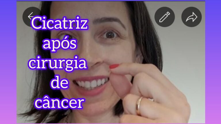 Imagens de Cirurgia para Carcinoma Basocelular
