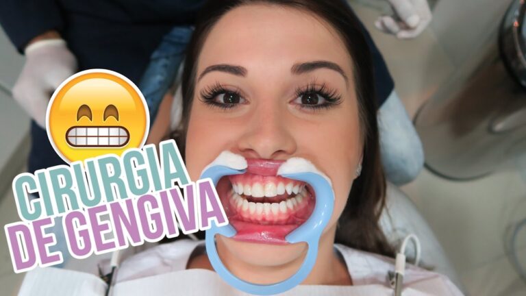 Tempo de Atestado Após Cirurgia na Gengiva