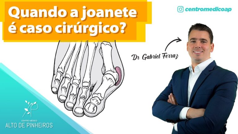 Raio X: Diagnóstico e Tratamento do Joanete