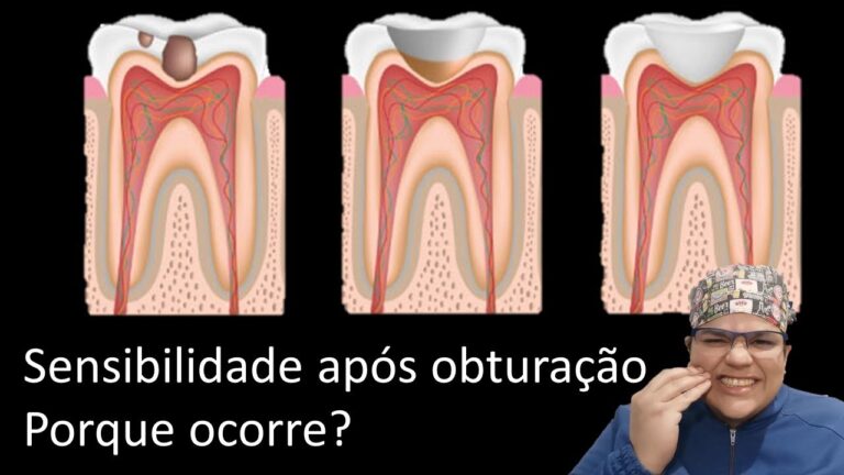 Dor no Dente Após Obturação: Causas e Soluções