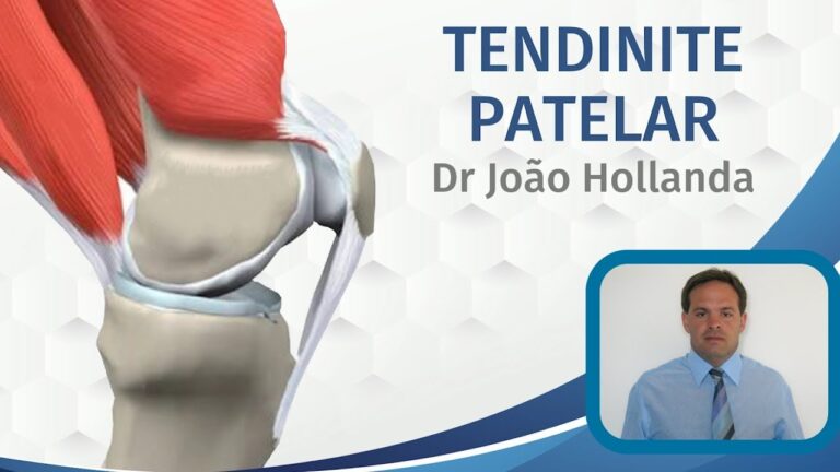 Especialistas em Tendinite Patelar: Tratamentos e Recomenda&ccedil;&otilde;es
