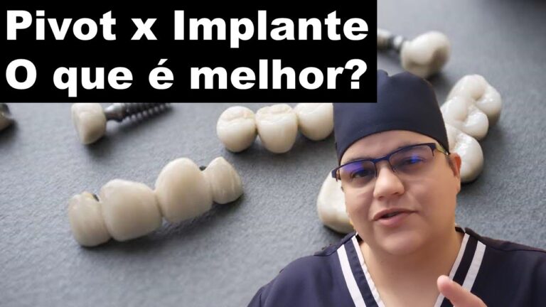 Pre&ccedil;o do Piv&ocirc; Dent&aacute;rio de Porcelana: O Que Voc&ecirc; Precisa Saber