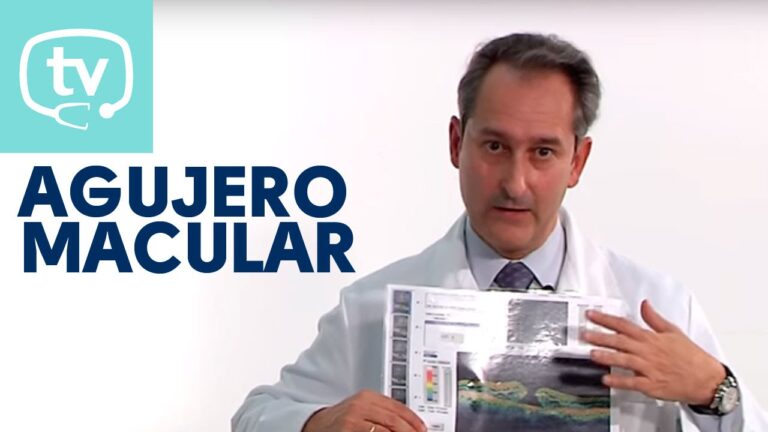 Entendendo a Cicatriz Macular: Causas e Tratamentos