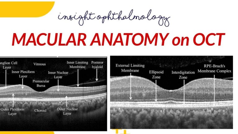 Macula Normal em OCT: Interpretação e Importância Clínica