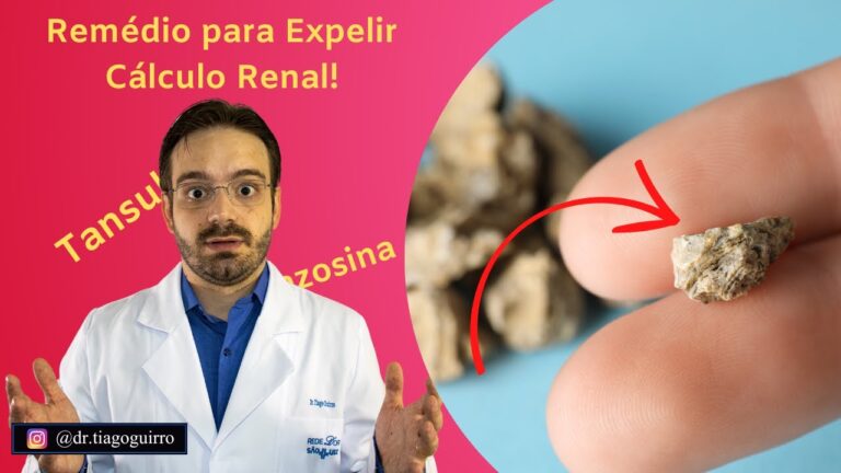 Como Expelir Pedra no Ureter Eficazmente