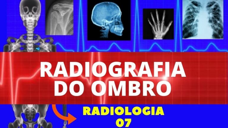 Raio X de Ombro: Diagnóstico de Fraturas