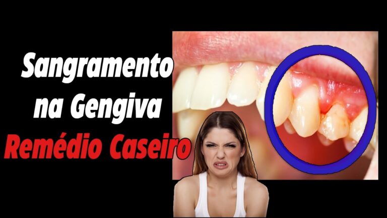 Remédios Caseiros Eficazes para Gengivas Inflamadas