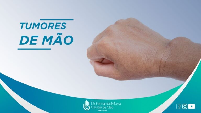 Tumor na Máo: Entendendo as Fotos e Diagnósticos