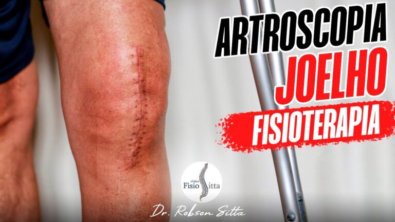 Guia Completo para Recuperação da Artroscopia do Joelho