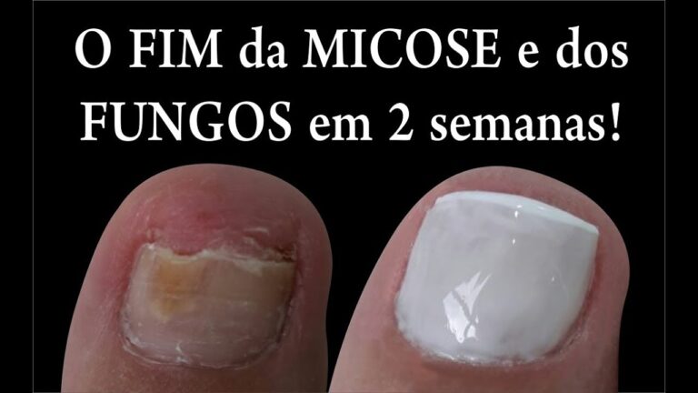 Andriodermol: Tempo para Ver Efeitos e Resultados