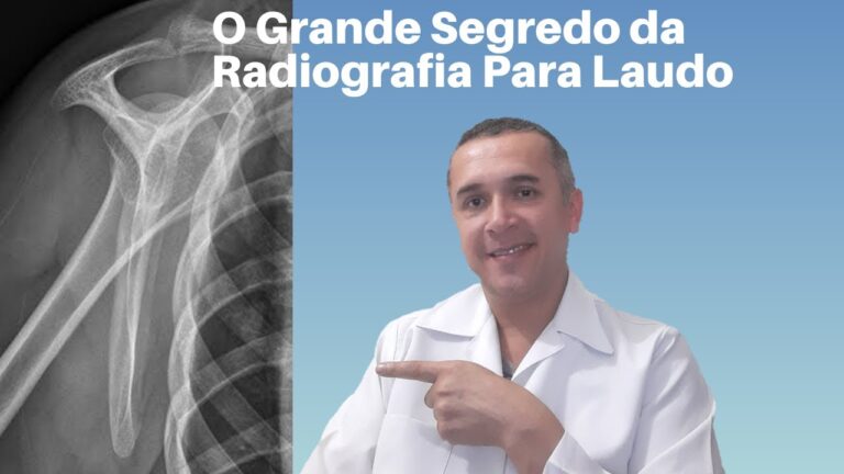 Exemplo Prático de Laudo de Raio X