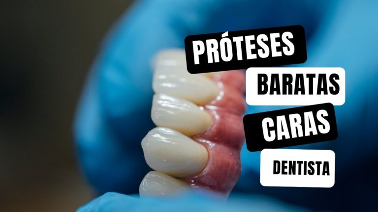 Tipos de Prótese Dentária Fixa: Guia Completo