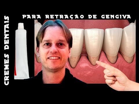 Melhor Creme Dental para Combater a Gengivite