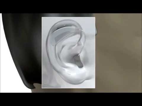 Entendendo o Retroauricular: O Que É e Sua Importância