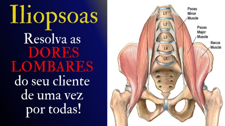 Alívio da Dor no Psoas: Causas e Tratamentos Eficazes