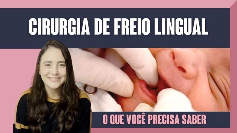 Cirurgia para Língua Presa em Bebês: O Que Você Precisa Saber