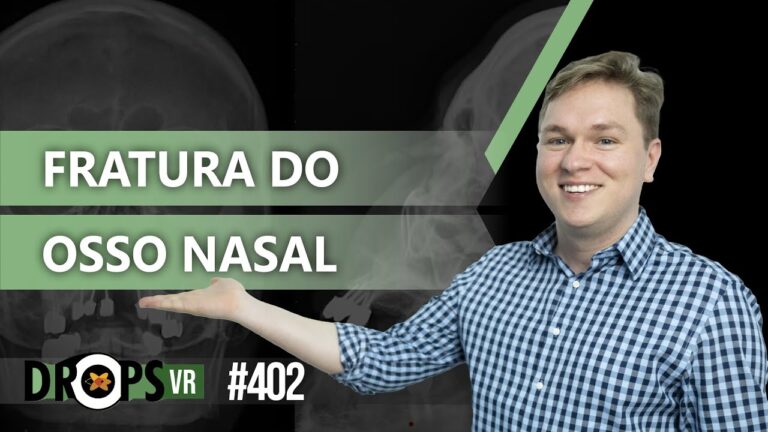 Radiografia Septo Nasal: Importância e Interpretação