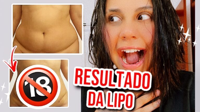 Transformações Impressionantes: Lipo nas Costas – Fotos Antes e Depois