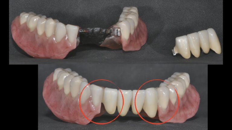 Roteiro Dentário: Guia Prático para Sorriso Saudável