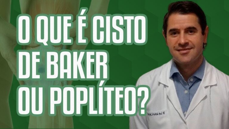 Cisto Poplíteo de Baker: Causas, Sintomas e Tratamentos