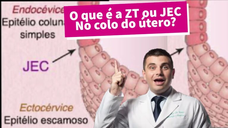 ZT Tipo 3: Um Guia Completo para Entender e Aplicar