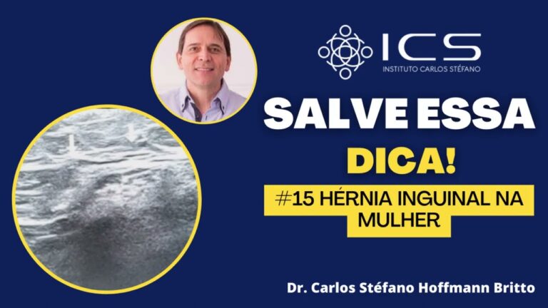 Hernia Inguinal em Mulheres: Causas, Sintomas e Tratamentos