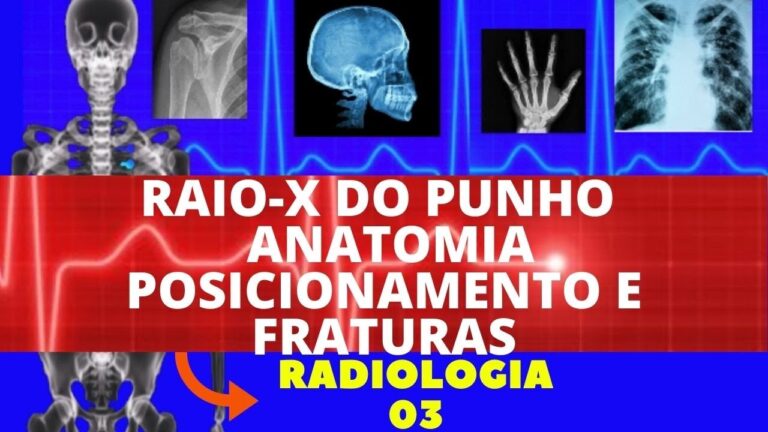Raio X do Punho: Interpretação de Resultados Normais