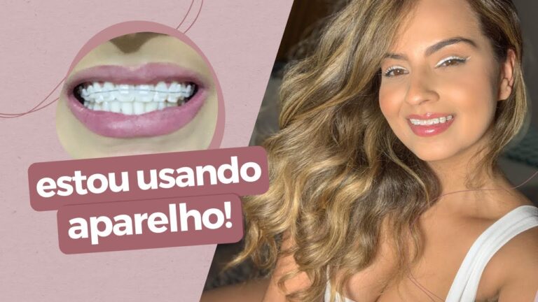 Aparelho Fixo de Porcelana: Estética e Funcionalidade em Ortodontia