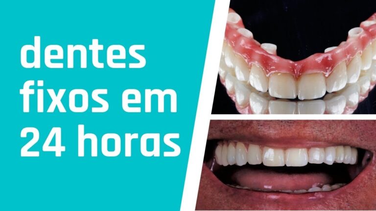 Protocolo Eficiente para Fotos de Prótese