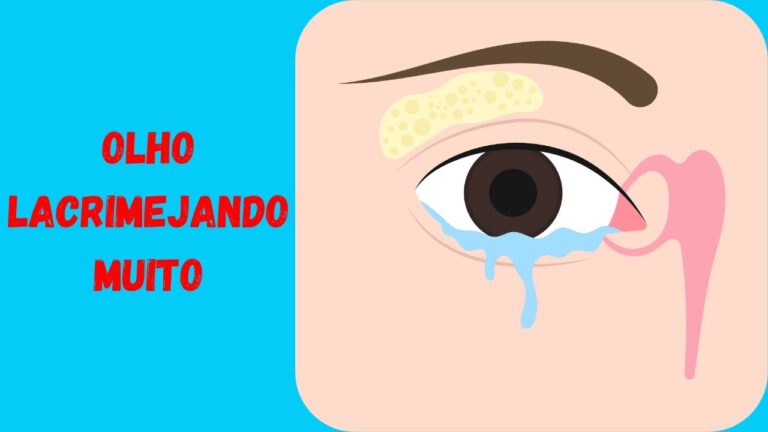 Causas e Soluções para Olho Lacrimejando Sem Parar
