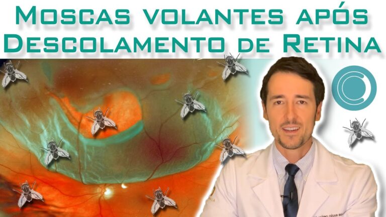 Moscas Volantes Após Vitrectomia: Causas e Soluções