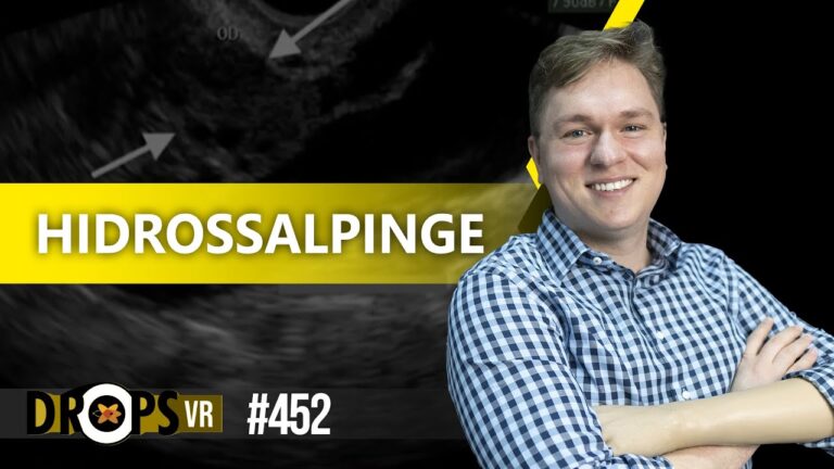 Hidrossalpinge: Diagnóstico Preciso por Ultrassom