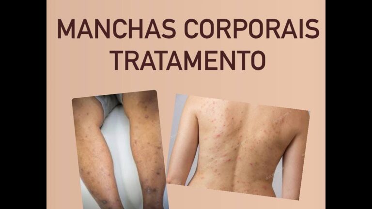 Causas e Cuidados para Machucados que Ficam Pretos