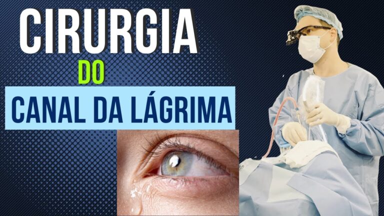 Recuperação Eficiente da Cirurgia do Canal Lacrimal