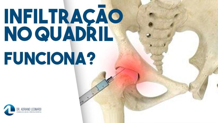 Inje&ccedil;&atilde;o para Bursite no Quadril: Al&iacute;vio e Tratamento Eficaz