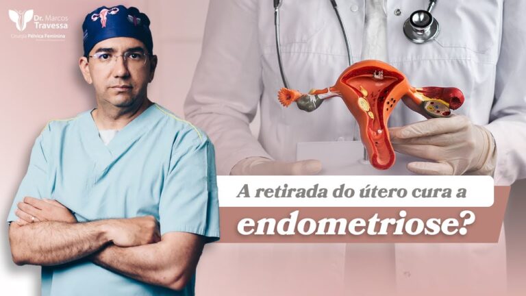 Retirar os Ovários: Solução Eficaz para a Endometriose?