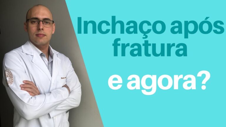 P&eacute; Inchado Ap&oacute;s Remo&ccedil;&atilde;o do Gesso: O Que Fazer?