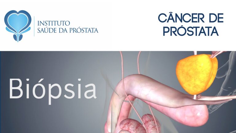 Valor da Ultrassonografia Transretal de Próstata com Biópsia